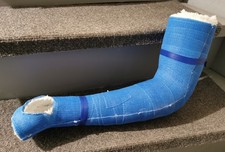 Gipsarm berarmgips blau gebraucht kaufen  Willstätt