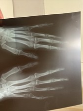 x ray film for sale x ray film for sale Clyde
