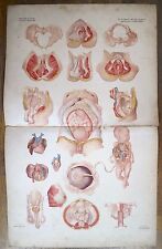 Lithographie périnée organes d'occasion  Paris II