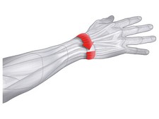 Sensiplast handgelenkbandage e gebraucht kaufen  Zehdenick