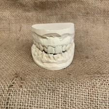 Vintage plaster teeth for sale  STOKE-ON-TRENT