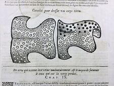 Prothèse gynécologique 1614 d'occasion  Tuchan
