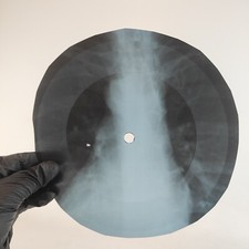 Usado, LED ZEPPELIN WHOLE LOTTA LOVE X-Ray USSR Record Roentgen Bone Ribs Music Vinyl comprar usado  Enviando para Brazil