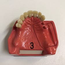 Dental dent schaumodell gebraucht kaufen  Bremen