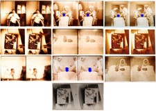 Photographies stéréos médic d'occasion  Versailles
