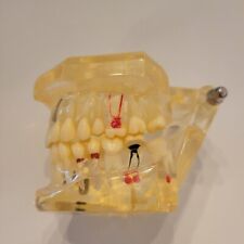 Usado, Implante adulto modelo ensino estudo dentes removível transparente tipodont dental  comprar usado  Enviando para Brazil