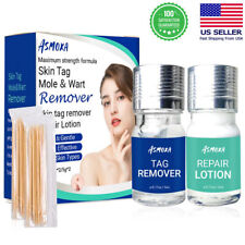 Skin tag remover for sale  Shipping to Ireland