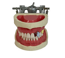 Modelo de exibição tipodonto dental Kilgore Nissin com dentes removíveis comprar usado  Enviando para Brazil