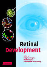 Retinal development excellent for sale  HEMEL HEMPSTEAD