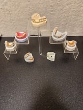 Zahntechnik dental schaumodell gebraucht kaufen  Hamburg