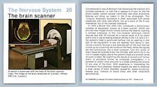 The Brain Scanner #20 Sistema Nervioso Guía Médica para el Hogar 1975-8 Tarjeta Hamlyn segunda mano  Embacar hacia Argentina