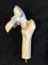 Osteoarthritis Osteophyte Anatomical Femur Pathology Model for sale  Shipping to South Africa