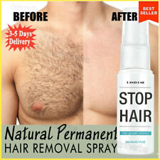 Permanent hair removal for sale  Dayton