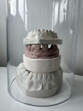 Old teeth cast for sale  MACCLESFIELD