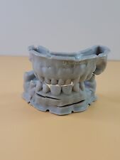 Molde de dientes impreso en 3D impresión implante dental molde decoración rarezas extraño  segunda mano  Embacar hacia Mexico
