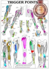 Trigger points part for sale  Shipping to Ireland