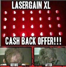 Laser comb hair for sale  Clearwater