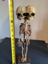 Infant fetus skeleton for sale  Shipping to Ireland