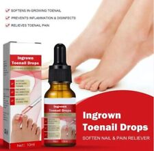 Ingrowth toenail correction for sale  SOUTHALL