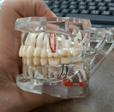 Dental teeth model for sale  Shipping to Ireland