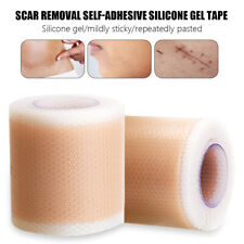 Scar removal silicone for sale  LIVERPOOL