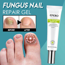 Nail treatment feet for sale  Shipping to Ireland