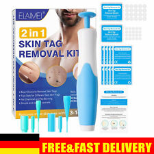 Wart remover kit for sale  Shipping to Ireland