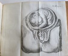 1784 ARTE DE OBSTETRÍCIA ILUSTRADA com 27 GRAVURAS ginecologia antiga  comprar usado  Enviando para Brazil