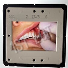 Usado, Boca abierta durante el procedimiento dental - Vista lateral de los dientes, diapositiva de 35 mm segunda mano  Embacar hacia Argentina