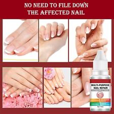 Fungal nail treatment for sale  SOUTHEND-ON-SEA