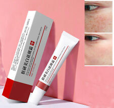 Whitening freckle cream for sale  Shipping to Ireland