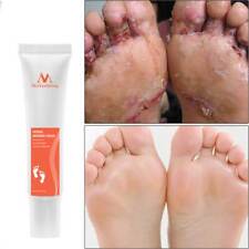 Foot Creams & Treatments for sale  Shipping to Ireland