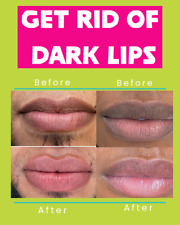Lip lightening bleaching for sale  HERTFORD