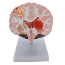 Realistic human brain for sale  Shipping to Ireland