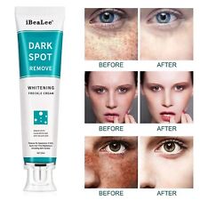 Ibealee whitening freckle for sale  LONDON