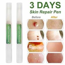 Skin tag removal for sale  ROMFORD