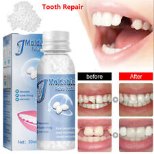 Temporary tooth repair for sale  Shipping to Ireland