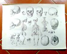 Disegno antico scheletro usato  Cremona