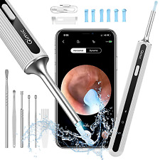 Otoscope oreille camera d'occasion  Paris X