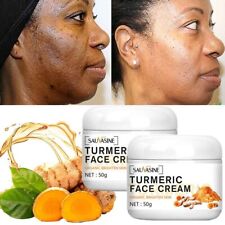 Turmeric face cream for sale  CANNOCK