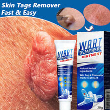 Wart remover genital for sale  Chicago