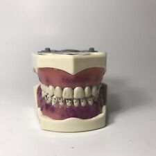 Usado, Columbia 860 tipo dental tipo tipo gengival doença aparência Halloween ferramenta dentista comprar usado  Enviando para Brazil