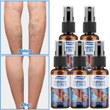 Varicose veins miracle for sale  MANCHESTER