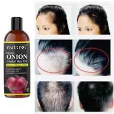 Herbs biotin Red Onion Oil for Hair Growth & Dandruff, Hair Fall Control 50ml for sale  Shipping to South Africa