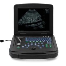 Smartbook portable ultrasound for sale  OSSETT