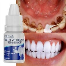 Teeth whitening essences for sale  Shipping to Ireland