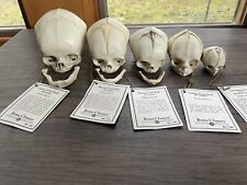 Bone clones fetal for sale  South Hadley