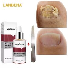 Lanbena nail repair for sale  HUDDERSFIELD