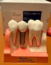 Kilgore dental implant for sale  Orlando