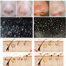 10pcs nose blackhead for sale  Shipping to Ireland
